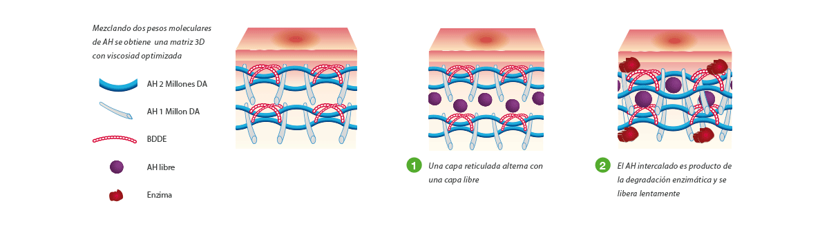 Ácido hialurónico libre y reticulado