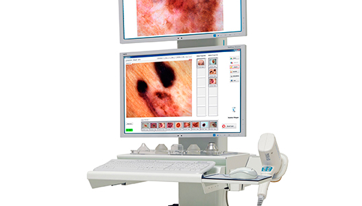 Dermatoscopio digital 1