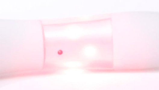 pelvic floor toning and vaginal rejuvenation