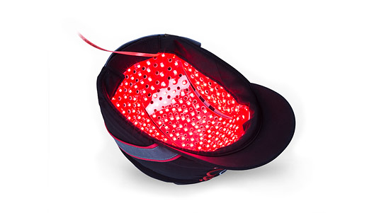 alopecia tratamiento hr3