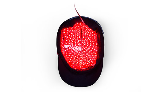 alopecia tratamiento hr3